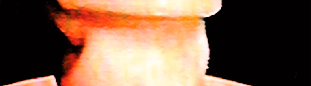 The Bends